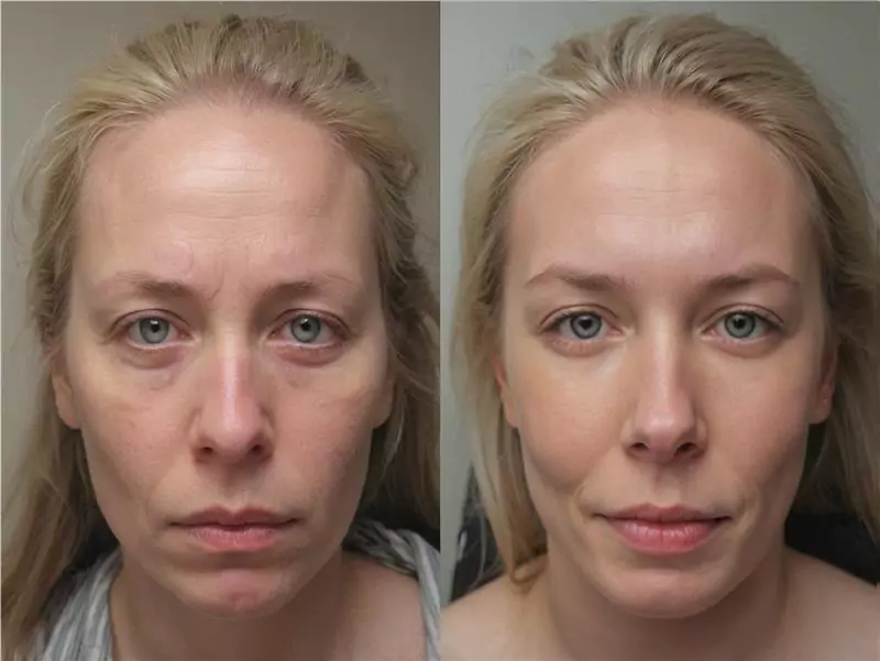 DeepSleep Bliss Reviews 2